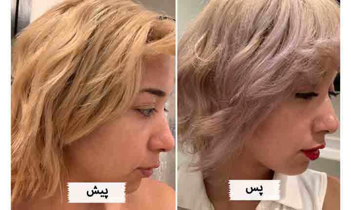 نتیجه استفاده از شامپو ضد زردی