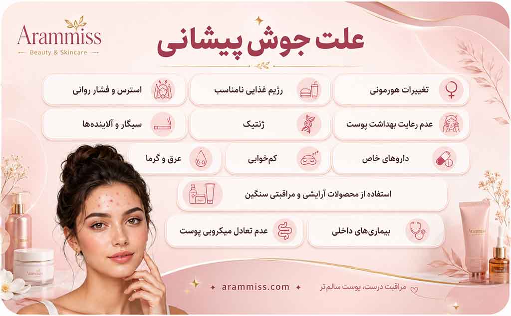 علت جوش پیشانی