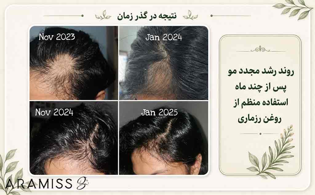 خواص روغن رزماری