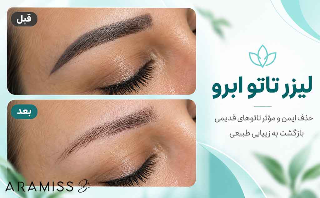 پاک کردن تاتو ابرو